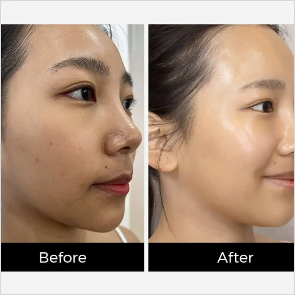 Medisco Aqua Boost Serum - Image 4